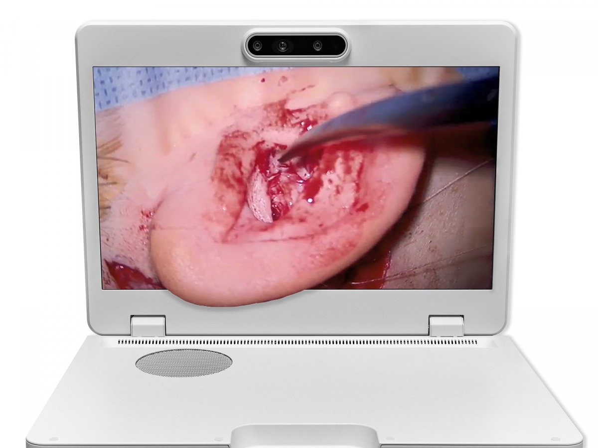 达擎之＂Heads-up 3D显微手术显示系统＂，整合4K裸眼3D显示及眼球追踪系统，具备快速追踪人眼移动位置功能，减轻医师长时间维持固定姿势的负担，让医师能有更宽广清晰的3D立体视野及更舒适的姿势来执行手术。